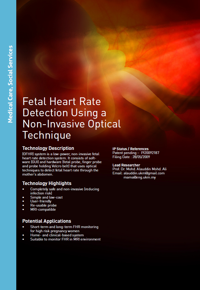 11_192_Fetal Heart Rate Detection Using a Non-Invasive Optical Technique